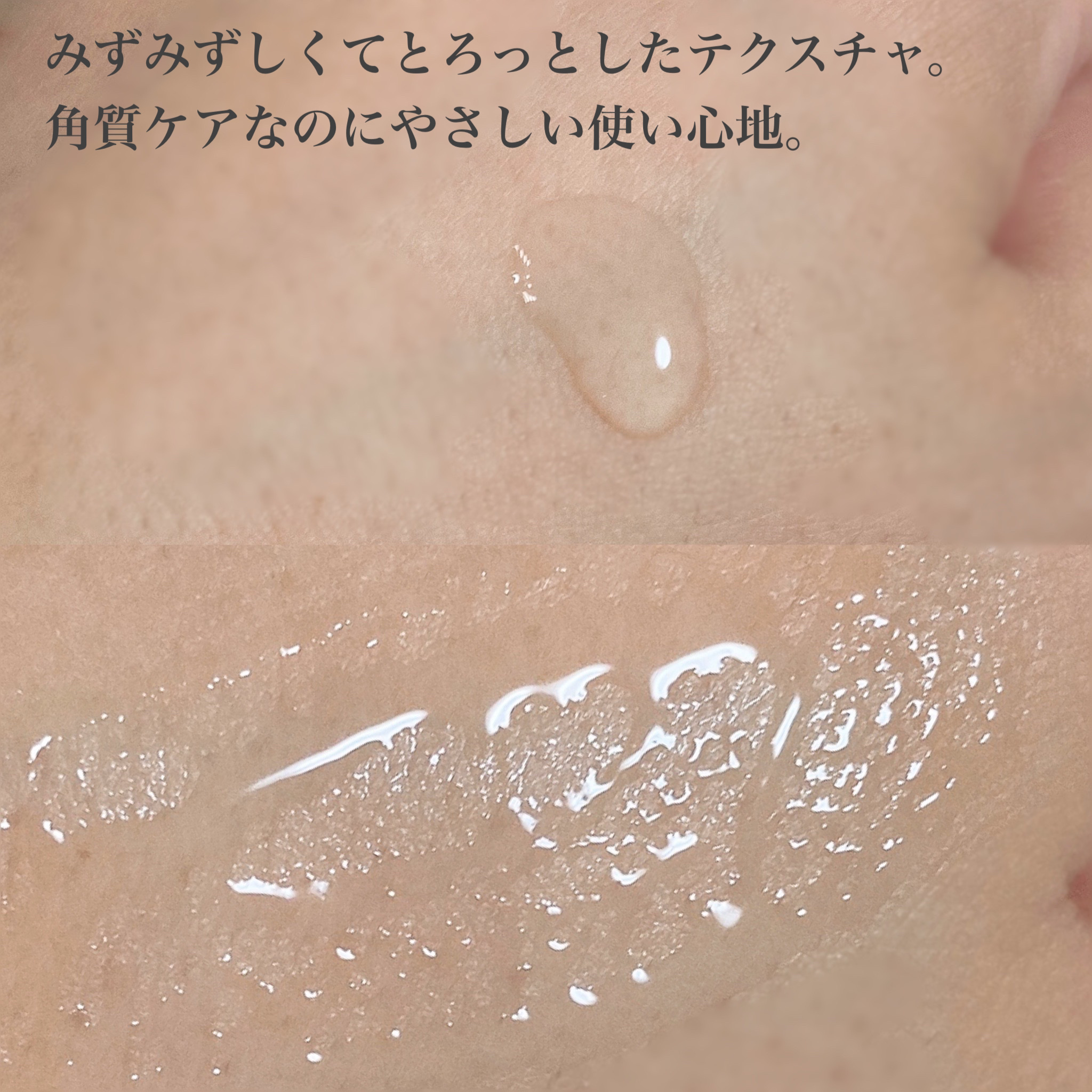 エファクラ ピールケア セラム/ラ ロッシュ ポゼ/美容液を使ったクチコミ（3枚目）