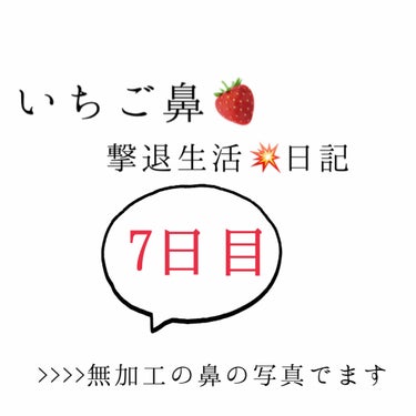 いちご鼻撃退日記7日目！

今日はののさんに教えて貰った方法でやってみました！

【方法】
①お風呂で毛穴を開かせる
②ワセリンを鼻全体に塗る
③10分放置した後に、ティッシュで拭き取る
④いつも通り洗