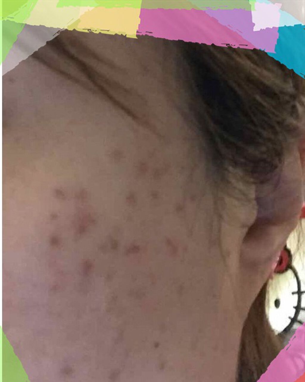 明色美顔水 薬用化粧水/美顔/化粧水を使ったクチコミ（1枚目）