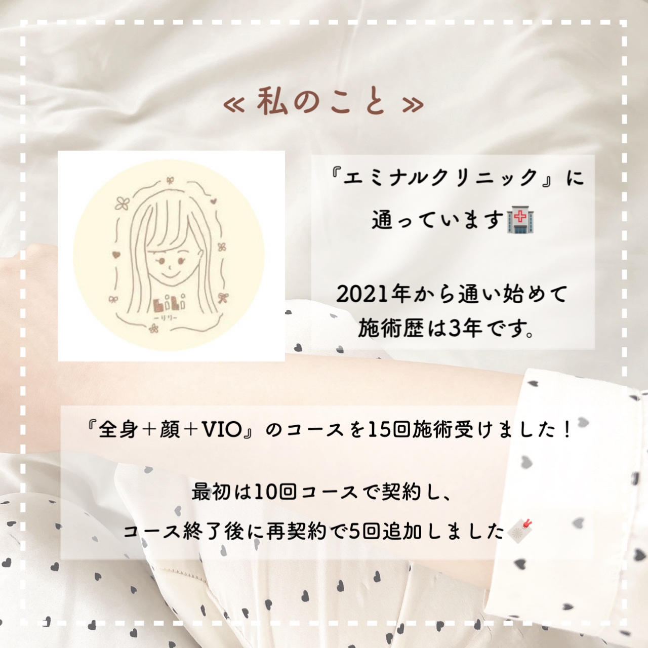 フェリエ フェイス用 ES-WF41/Panasonic/シェーバーを使ったクチコミ（2枚目）