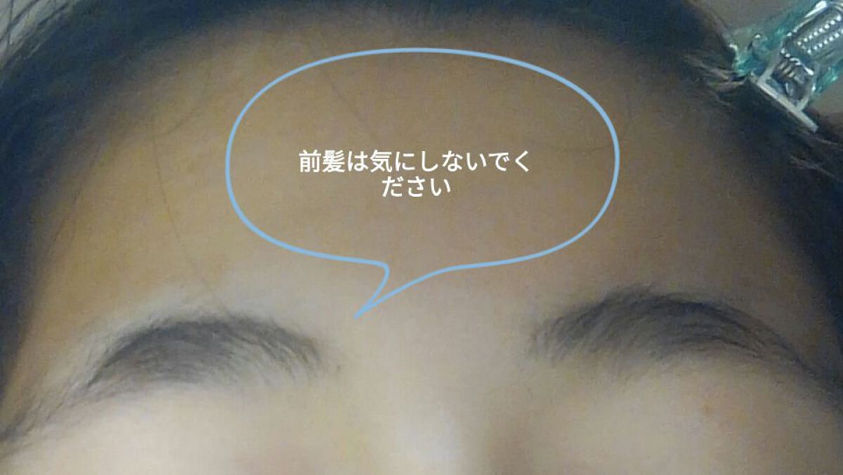 薬用クリア化粧水/メンソレータム アクネス/化粧水を使ったクチコミ（2枚目）