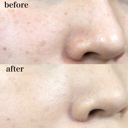 ドラマティックパウダリー EX/マキアージュ/パウダーファンデーションを使ったクチコミ(3枚目)