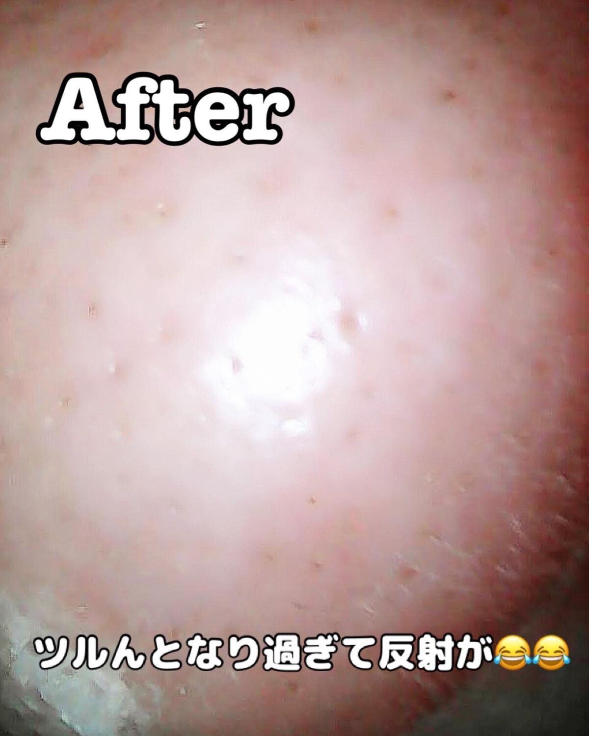 ゼロ毛穴パッド 2.0/MEDICUBE/トナーパッドを使ったクチコミ(7枚目)