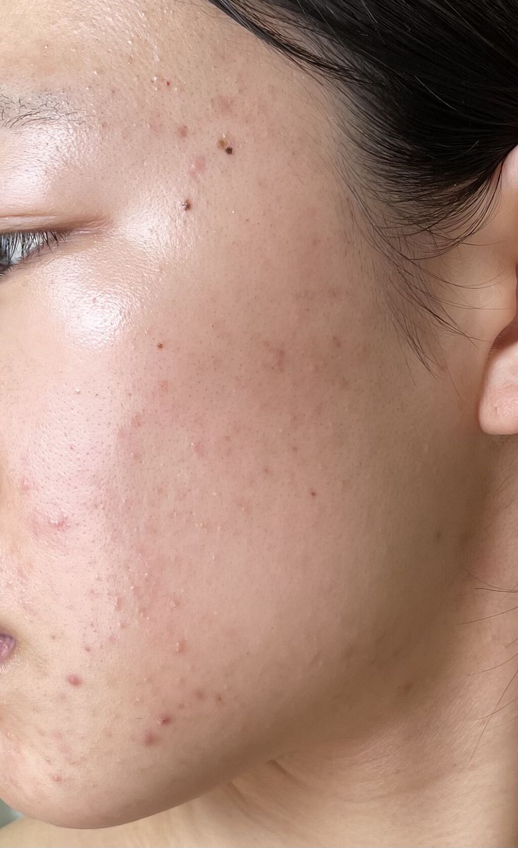 キールズ ハーバル トナー CL アルコールフリー/Kiehl's/化粧水を使ったクチコミ（3枚目）