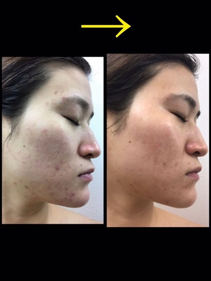 さぁや on LIPS 「皆様、こんにちは!今回ご紹介するのは、サロン専売品生プラセンタ..」(2枚目)