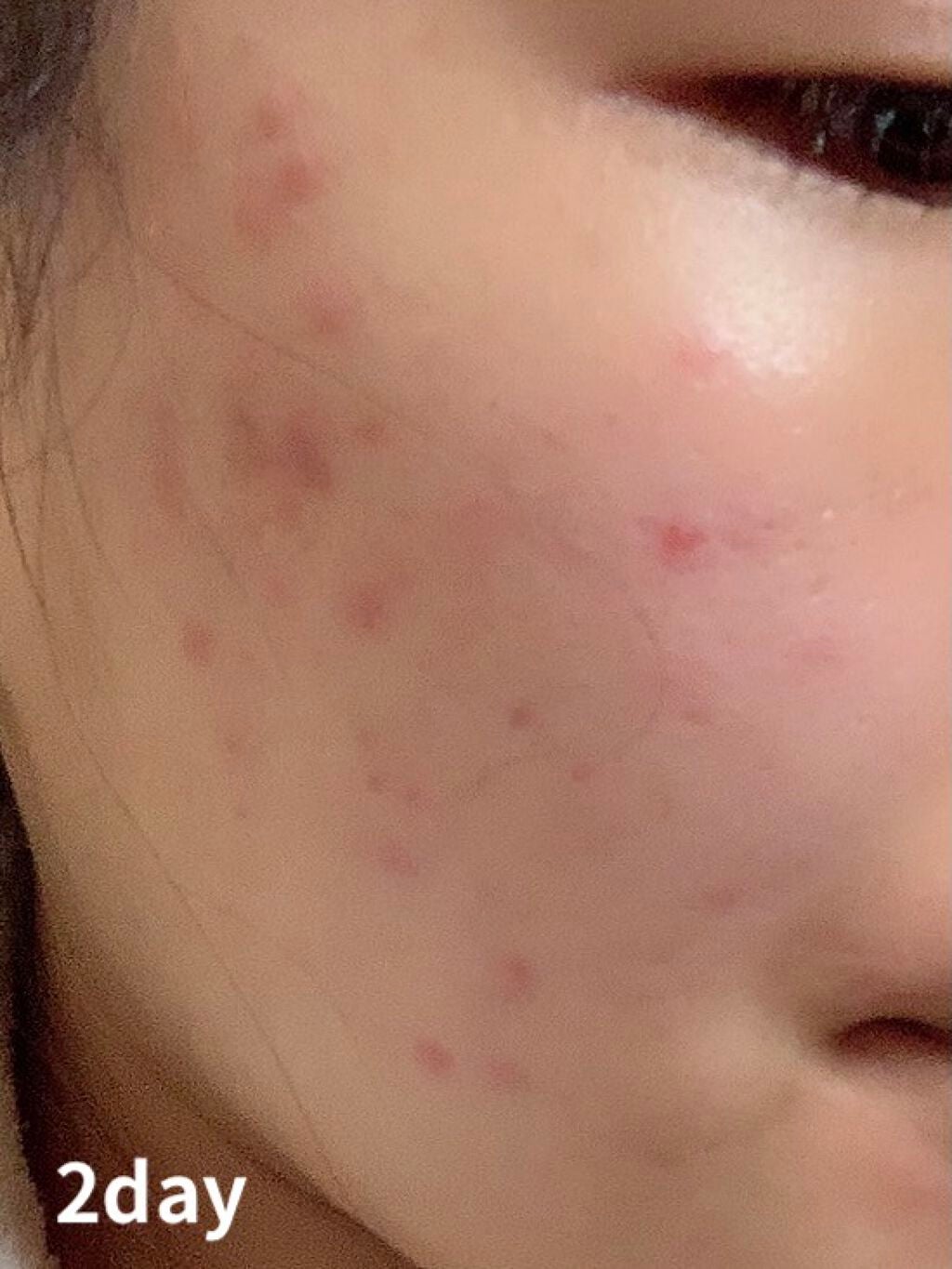 Tð on LIPS ãâ»ãèŠèŠããåçã§ãŸãããã«ã¡ã¯ïŒãšããã¥ãªã²ã«ããããããã..ãïŒ4æç®ïŒ