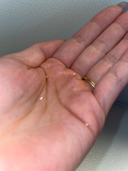 センテラ ライトクレンジングオイル/SKIN1004/オイルクレンジングを使ったクチコミ(2枚目)