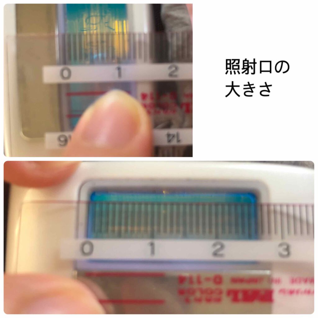 FASIZ607C IPL光脱毛器/FASIZ/家庭用脱毛器を使ったクチコミ(2枚目)