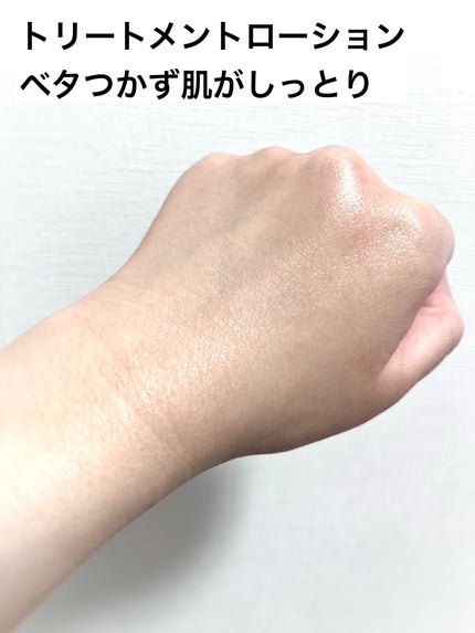 トリートメントローション (ブライトニング) とてもしっとり/アクアレーベル/化粧水を使ったクチコミ(4枚目)