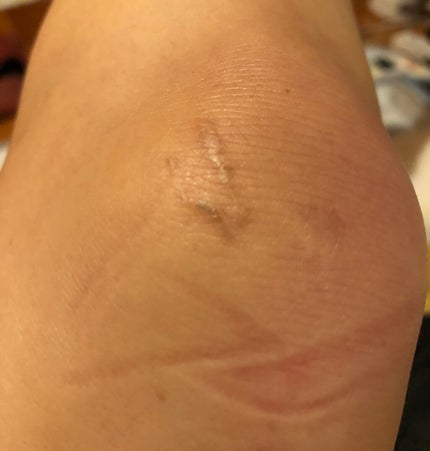 を使ったクチコミ(3枚目)