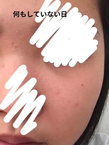 ティーツリーケア ソリューション エッセンシャルマスクEX/MEDIHEAL/シートマスク・パックを使ったクチコミ(1枚目)