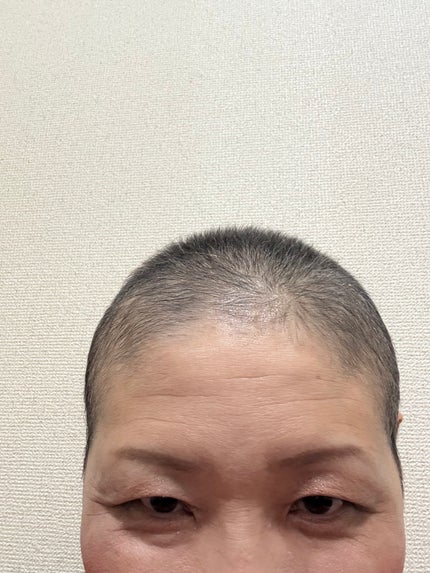 みほっぴ on LIPS 「今年は2月に乳がんの告知を受けがんサバイバーの仲間入りを果たし..」(10枚目)