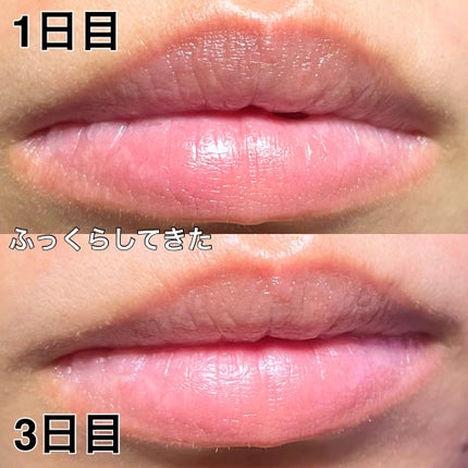 ゆーちゃか on LIPS 「どうにかしたい乾燥唇🫦プルプル唇パックでケアしてみた!・・・・..」(5枚目)