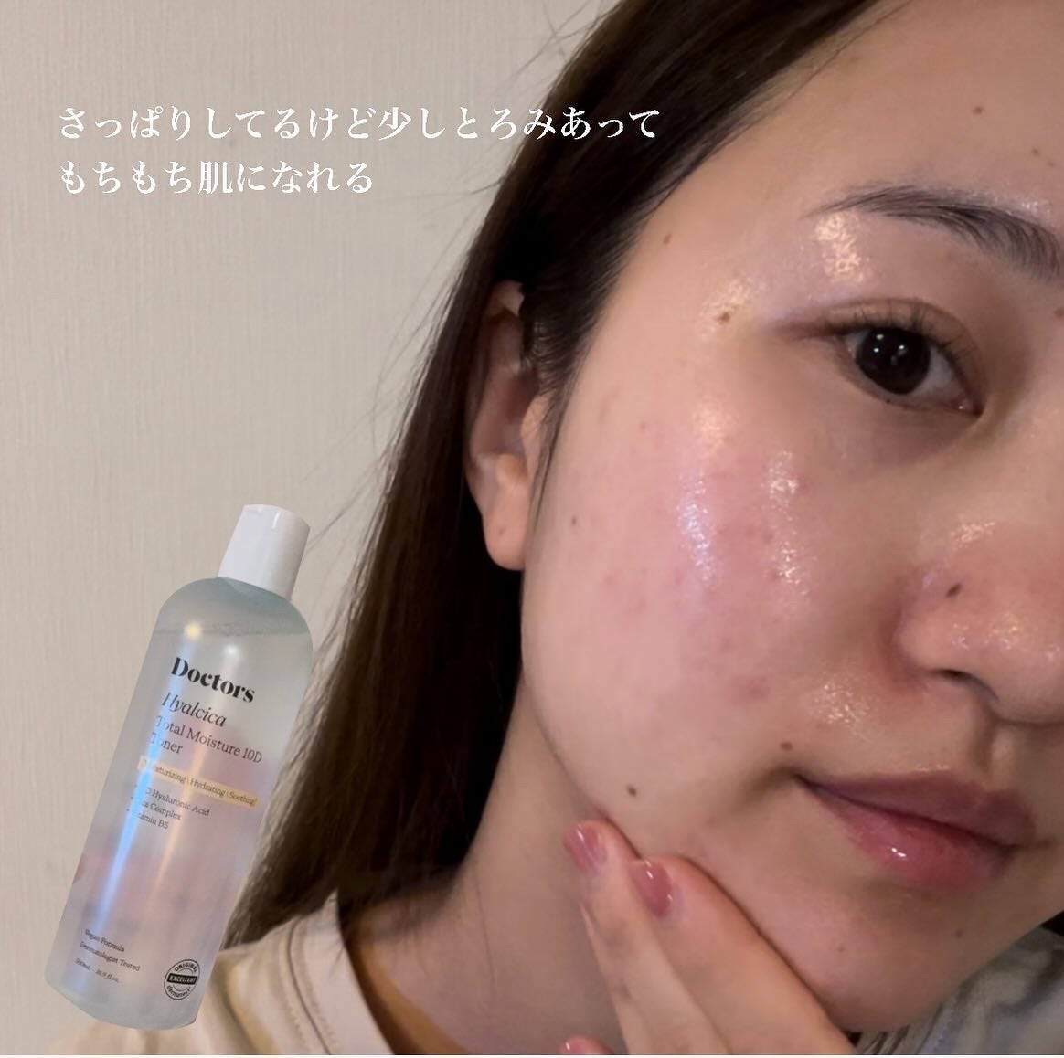 ヒアルシカトータルモイスチャー 10D トナー/theralogic/化粧水を使ったクチコミ(4枚目)