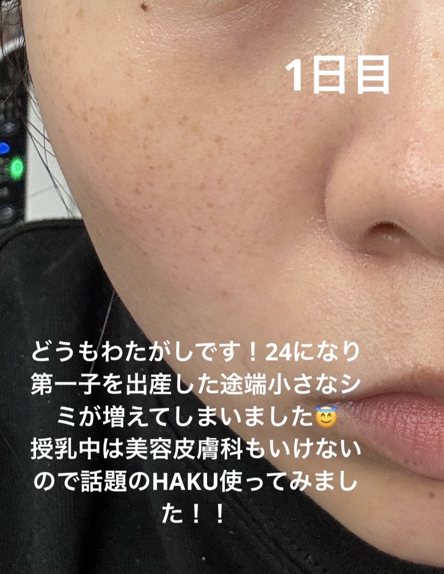 シミ・ソバカス予防ケア　フェイスクリーム/キュレル/フェイスクリームを使ったクチコミ（2枚目）