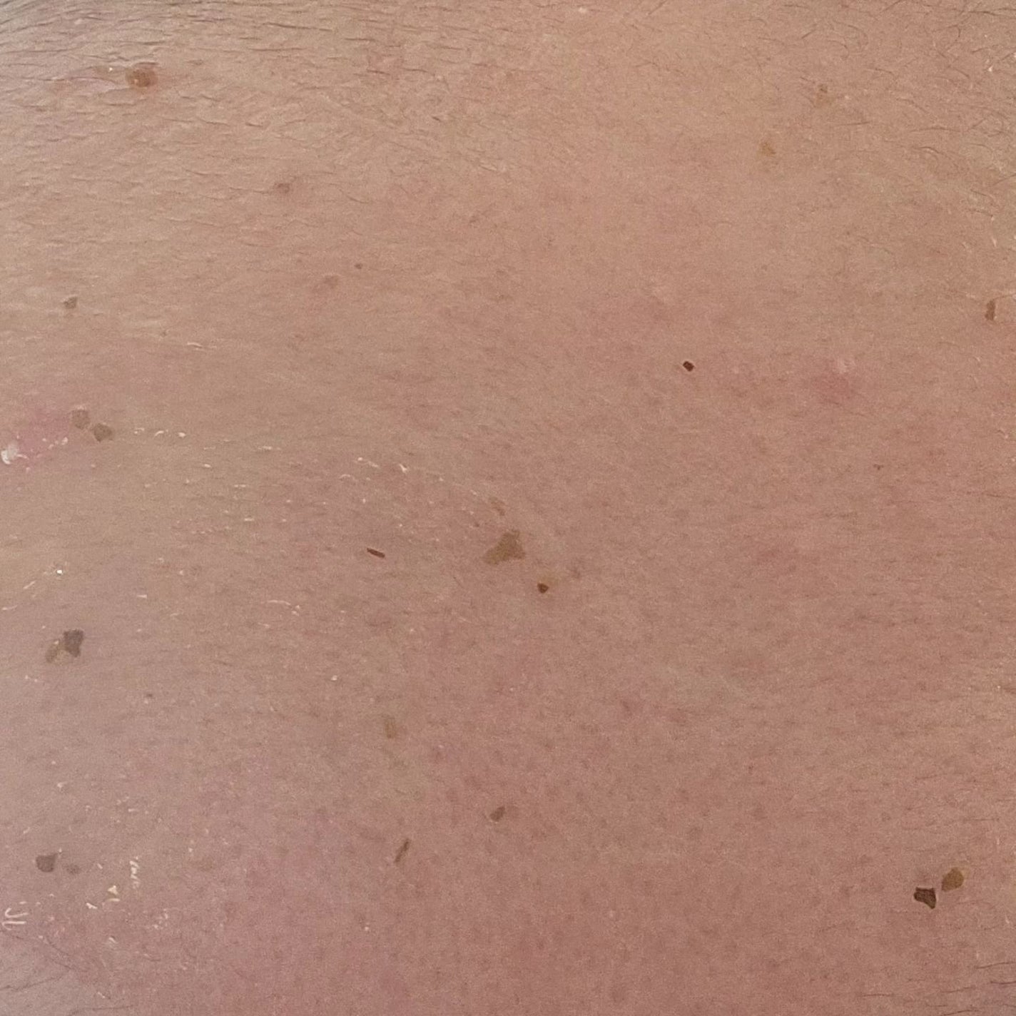 リアルシカペストパック/ビューランチ/洗い流すパック・マスクを使ったクチコミ(5枚目)