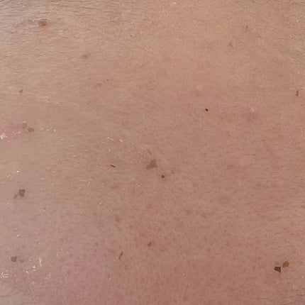 リアルシカペストパック/ビューランチ/洗い流すパック・マスクを使ったクチコミ(5枚目)