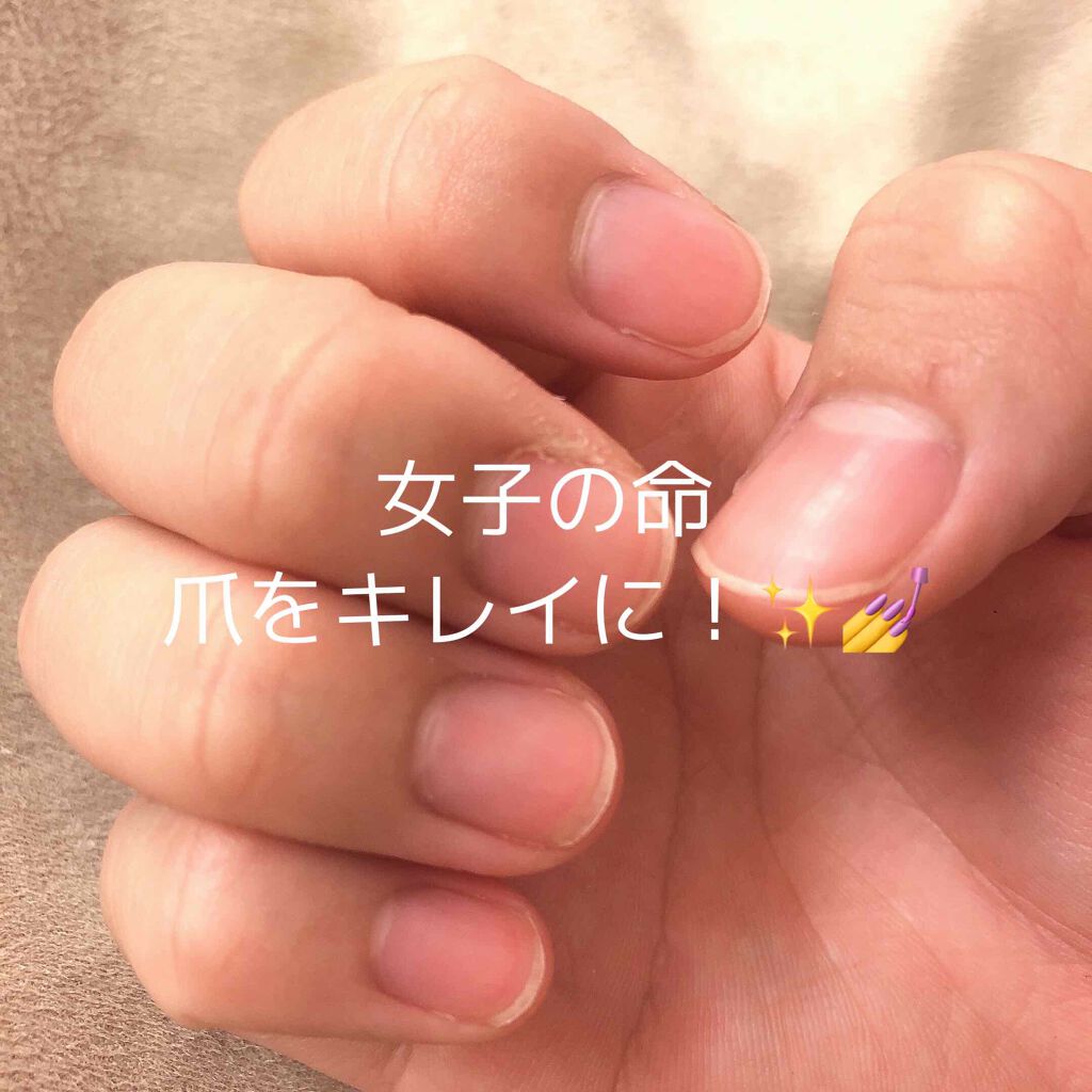 オリジナル ピュアスキンジェリー/ヴァセリン/ボディクリームを使ったクチコミ（1枚目）