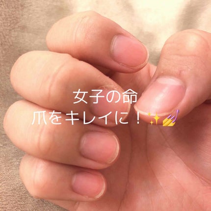 オリジナル ピュアスキンジェリー/ヴァセリン/ボディクリームを使ったクチコミ(1枚目)
