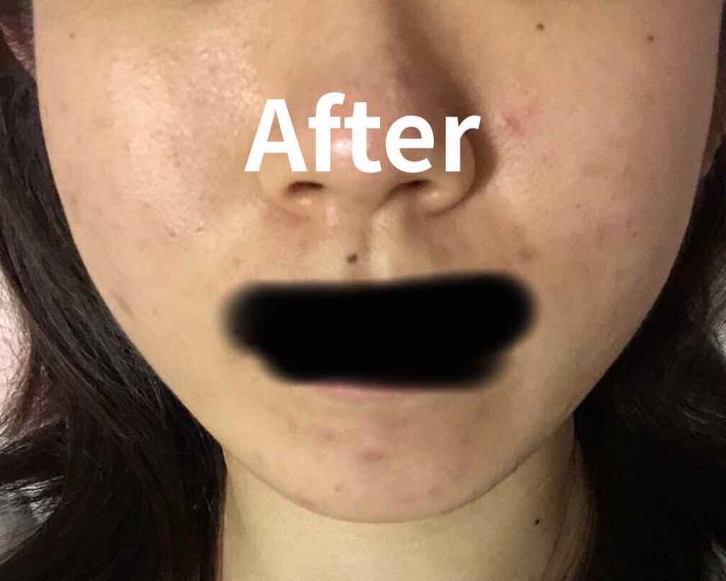 ジョンソン ベビーローション/ジョンソンベビー/ボディローションを使ったクチコミ（3枚目）