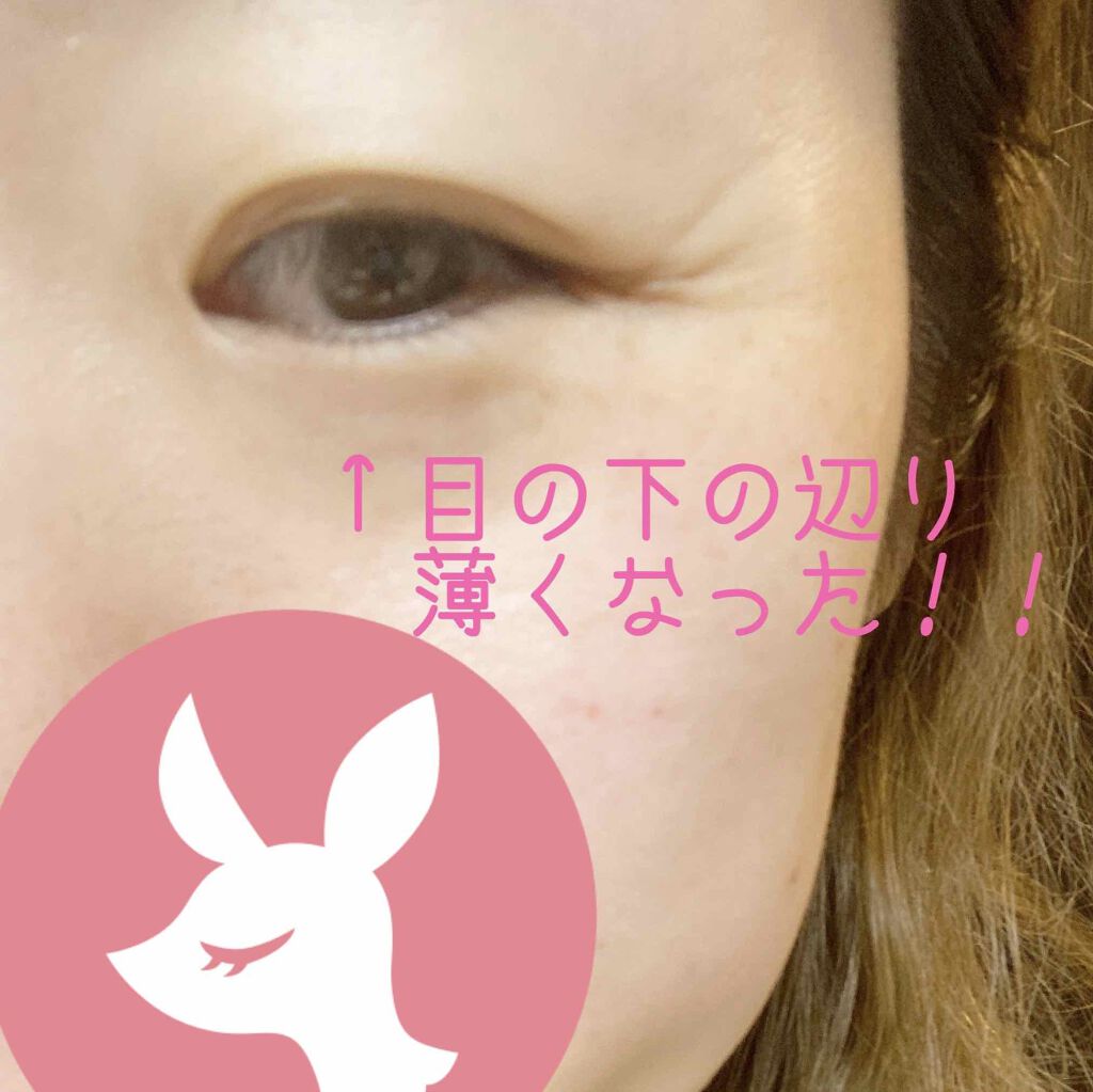 ヒアルロン酸原液/太陽のアロエ社/美容液を使ったクチコミ(3枚目)