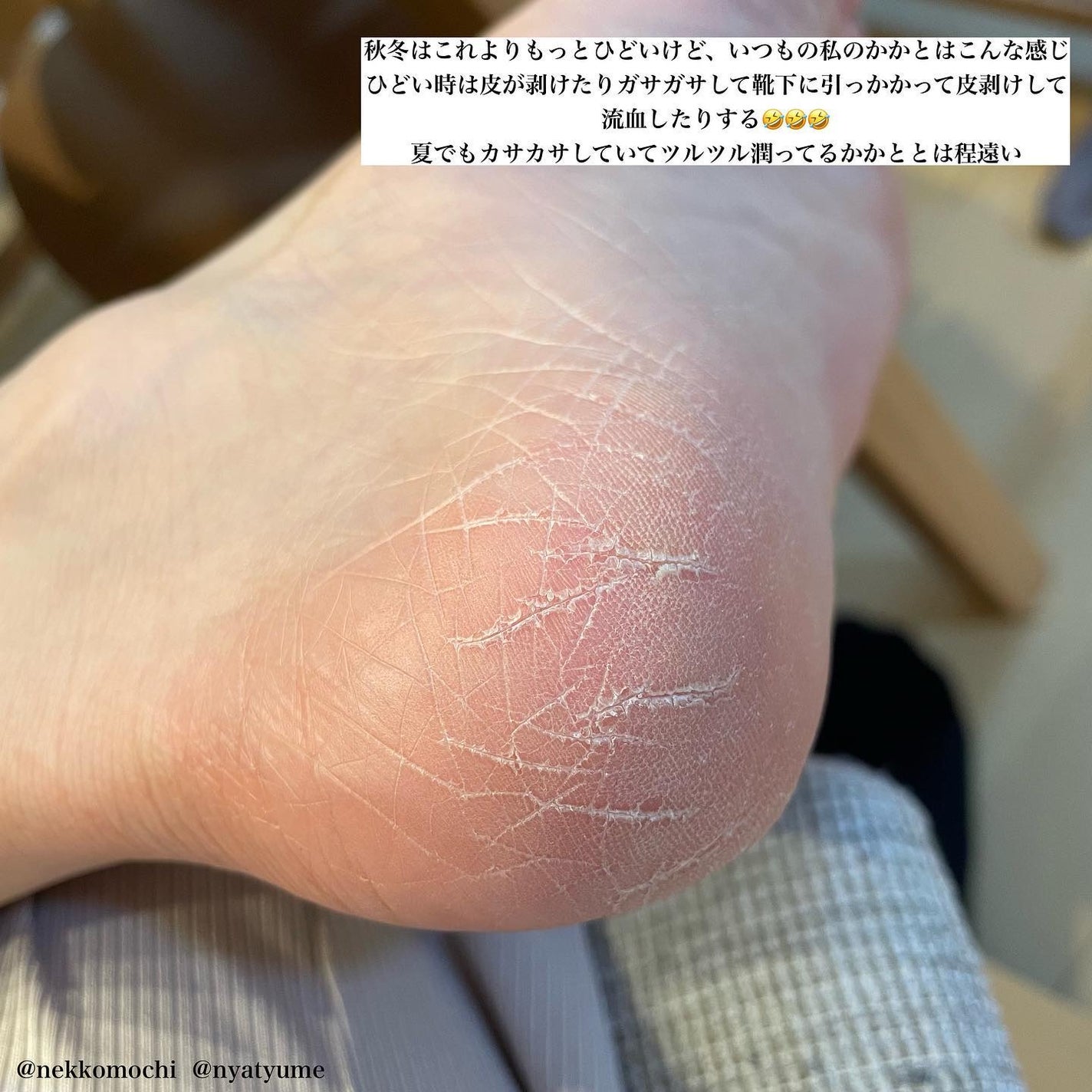 ゴウンバル クリーム/3WB/レッグ・フットケアを使ったクチコミ(3枚目)