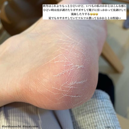 ゴウンバル クリーム/3WB/レッグ・フットケアを使ったクチコミ(3枚目)