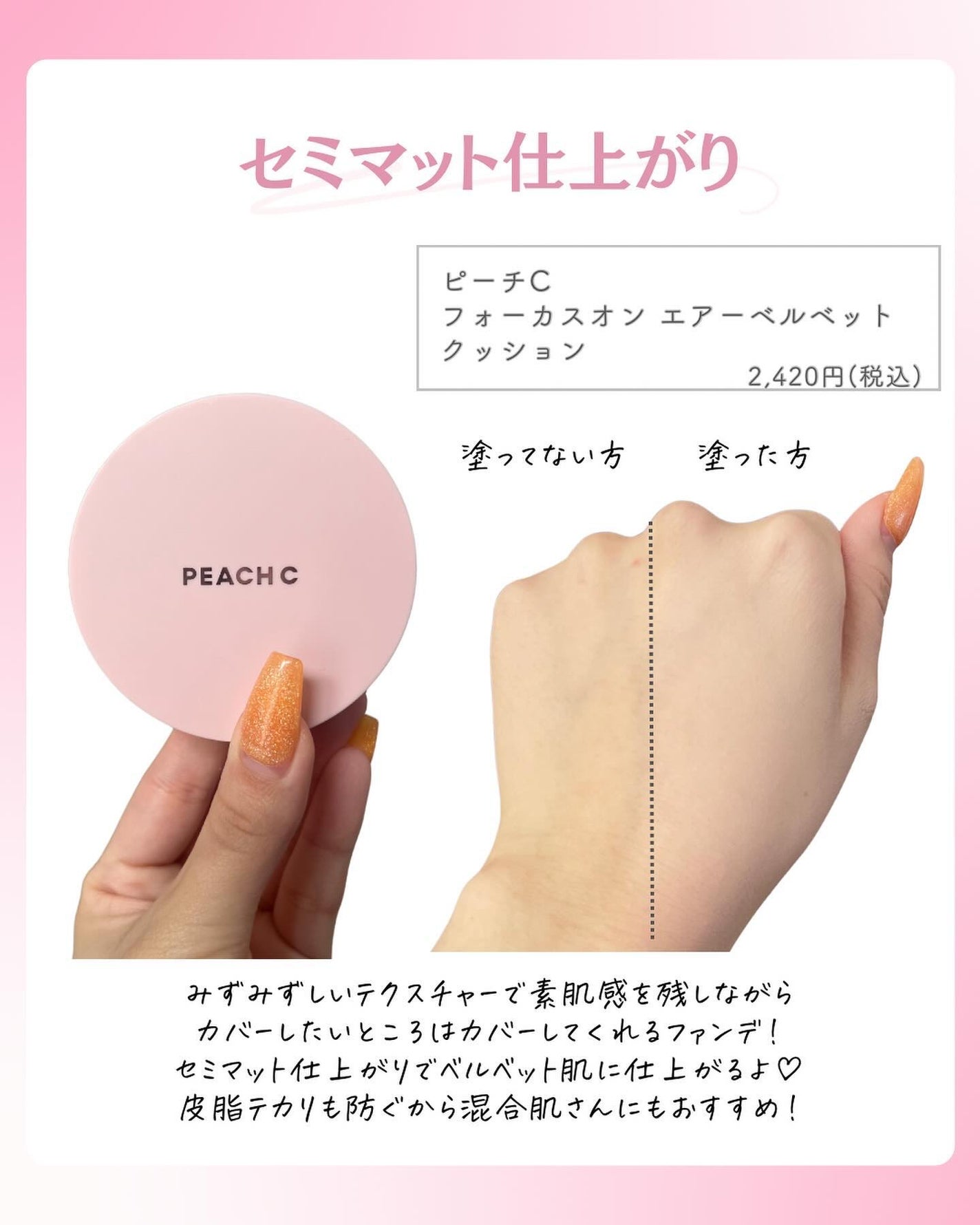 ðºð¬ðµðšðçŸå®¹ã¡ãã£ã¢ on LIPS ã@sena_biyouâïžâïžâïžä»ã®æçš¿ã¯ãã¡ãâšâšãã€ãã..ãïŒ5æç®ïŒ