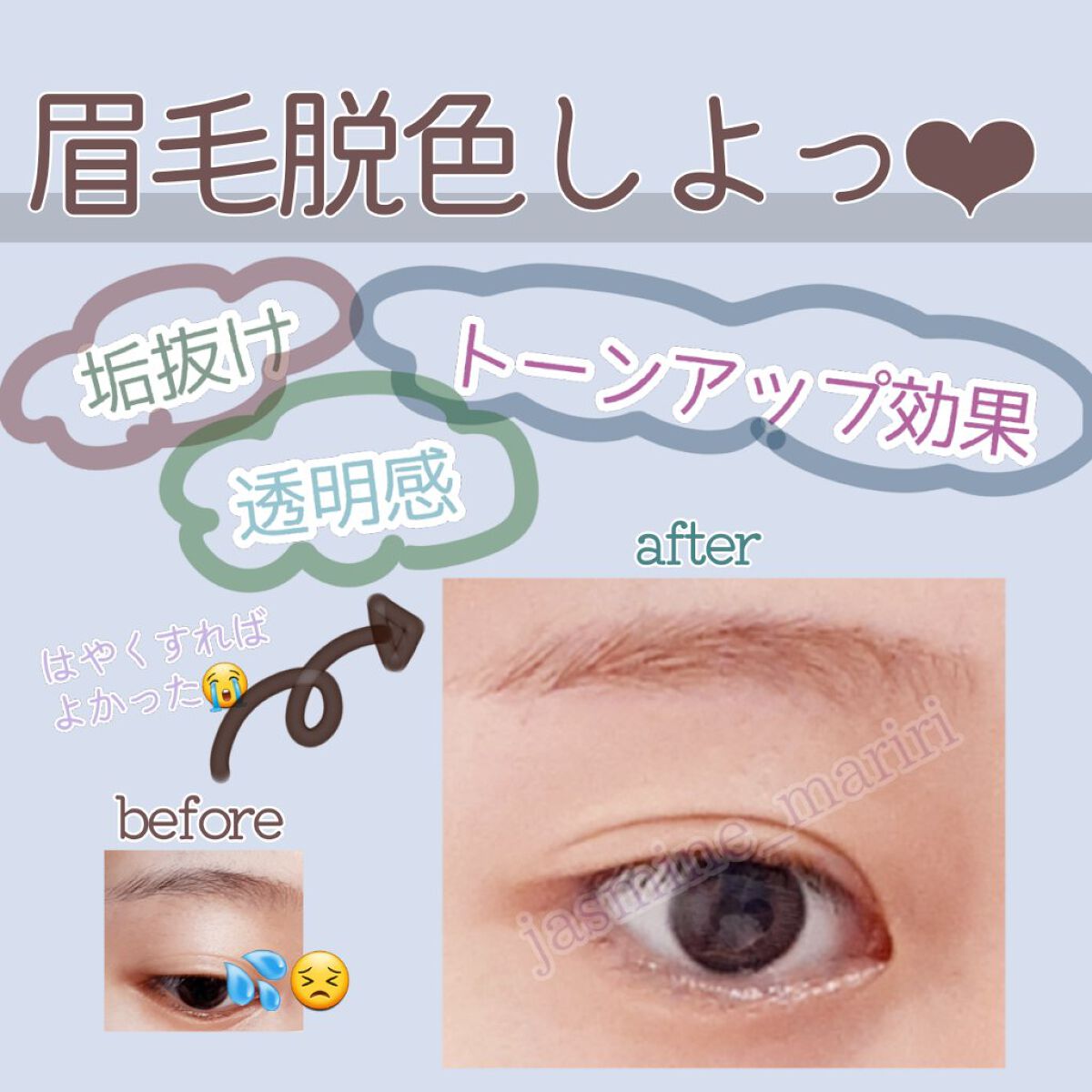 脱色クリーム 敏感肌用/エピラット/ムダ毛ケアを使ったクチコミ(1枚目)