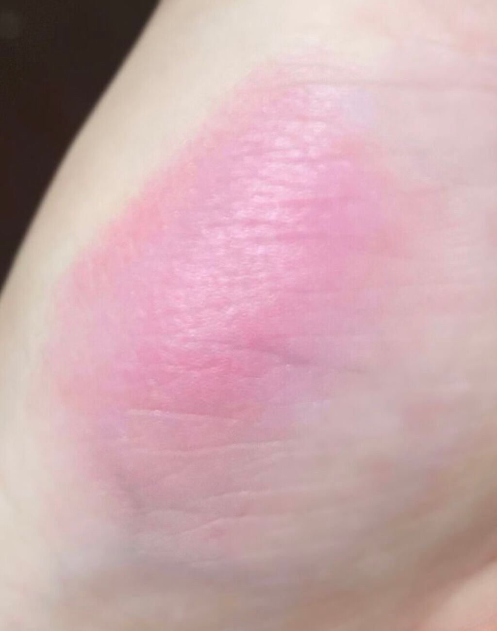 チーク ポップ/CLINIQUE/パウダーチークを使ったクチコミ(2枚目)