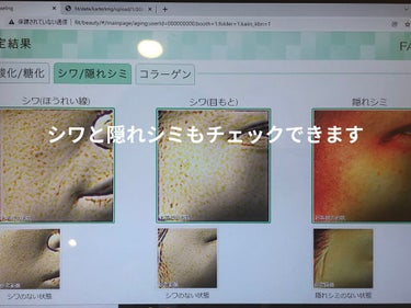 エンリッチプラス 乳液 II しっとり ＜医薬部外品＞/ファンケル/乳液を使ったクチコミ（3枚目）