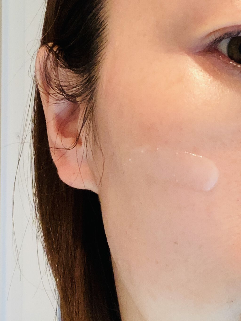 デュイセル シカプラスバーム/DEWYCEL/フェイスクリームを使ったクチコミ（3枚目）