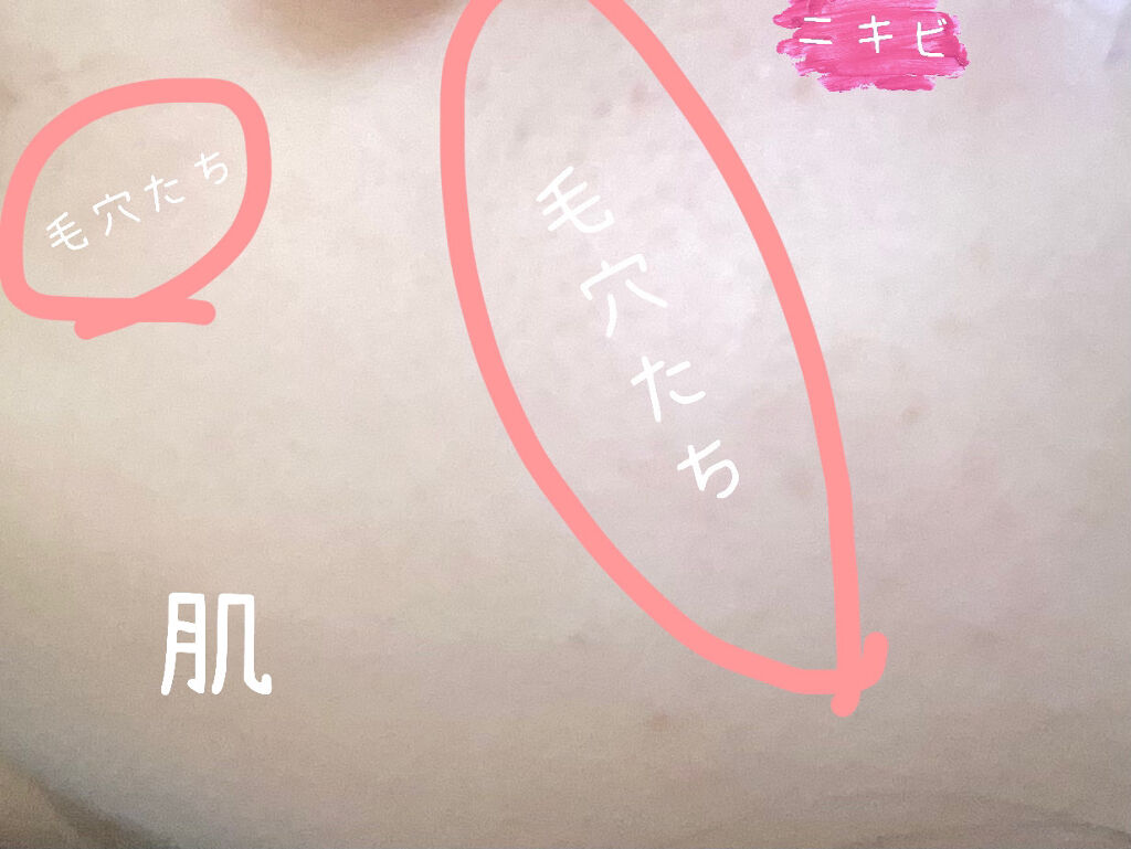 まとめ髪スティック スーパーホールド/マトメージュ/ヘアワックス・クリームを使ったクチコミ（3枚目）