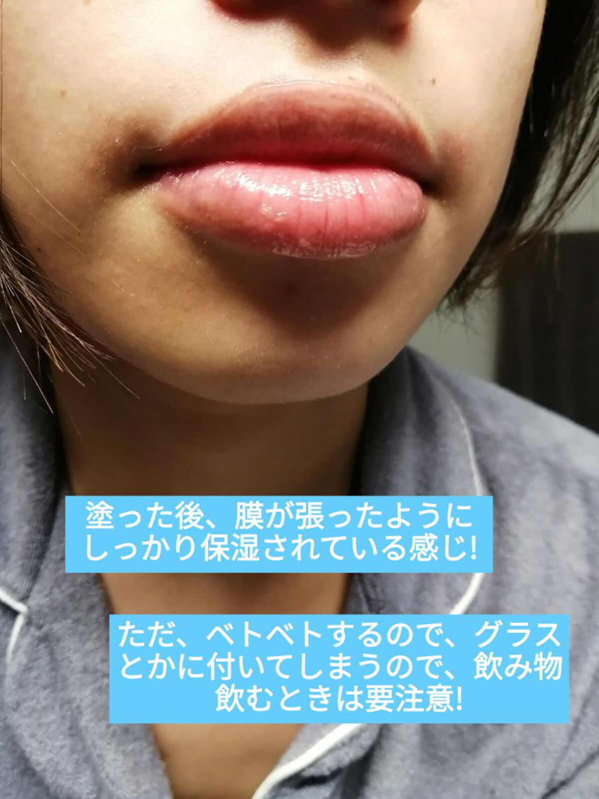 アトデルム リップクリーム/ビオデルマ/リップクリームを使ったクチコミ（3枚目）