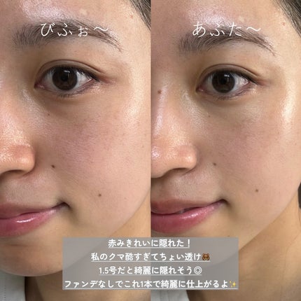 ダーマシンコンシーラー/23years old/リキッドコンシーラーを使ったクチコミ(5枚目)