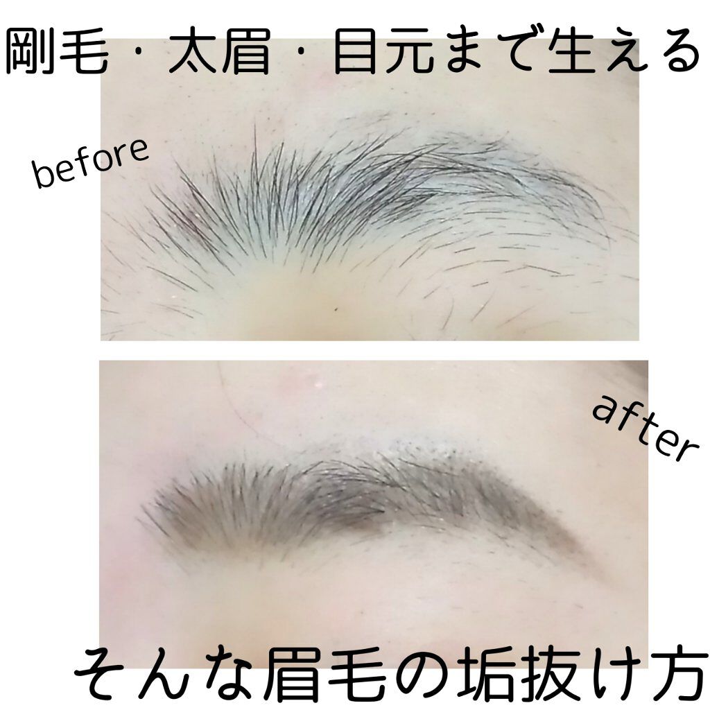 フェリエ フェイス用 ES-WF41/Panasonic/シェーバーを使ったクチコミ（1枚目）