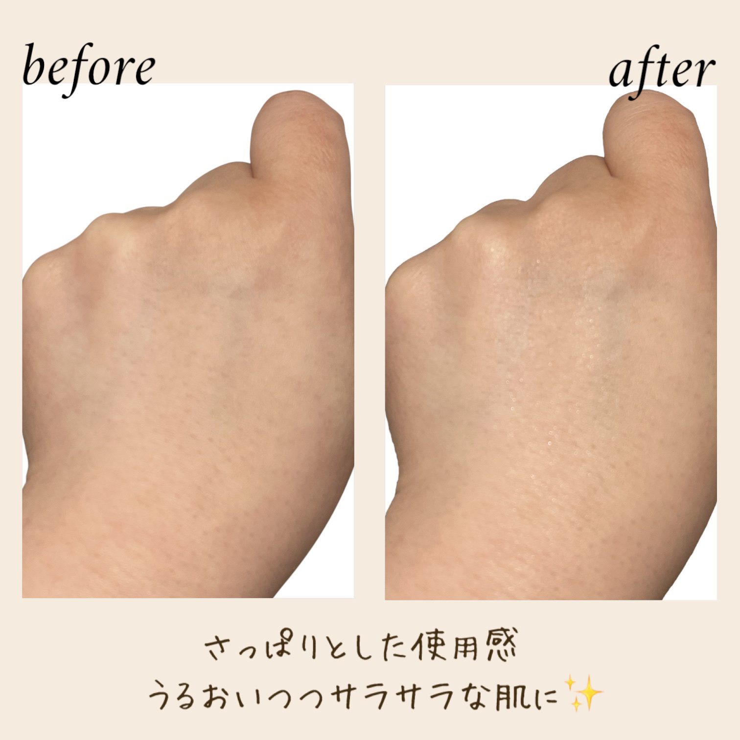 薬用パウダー化粧水/メンソレータム アクネス/化粧水を使ったクチコミ（3枚目）