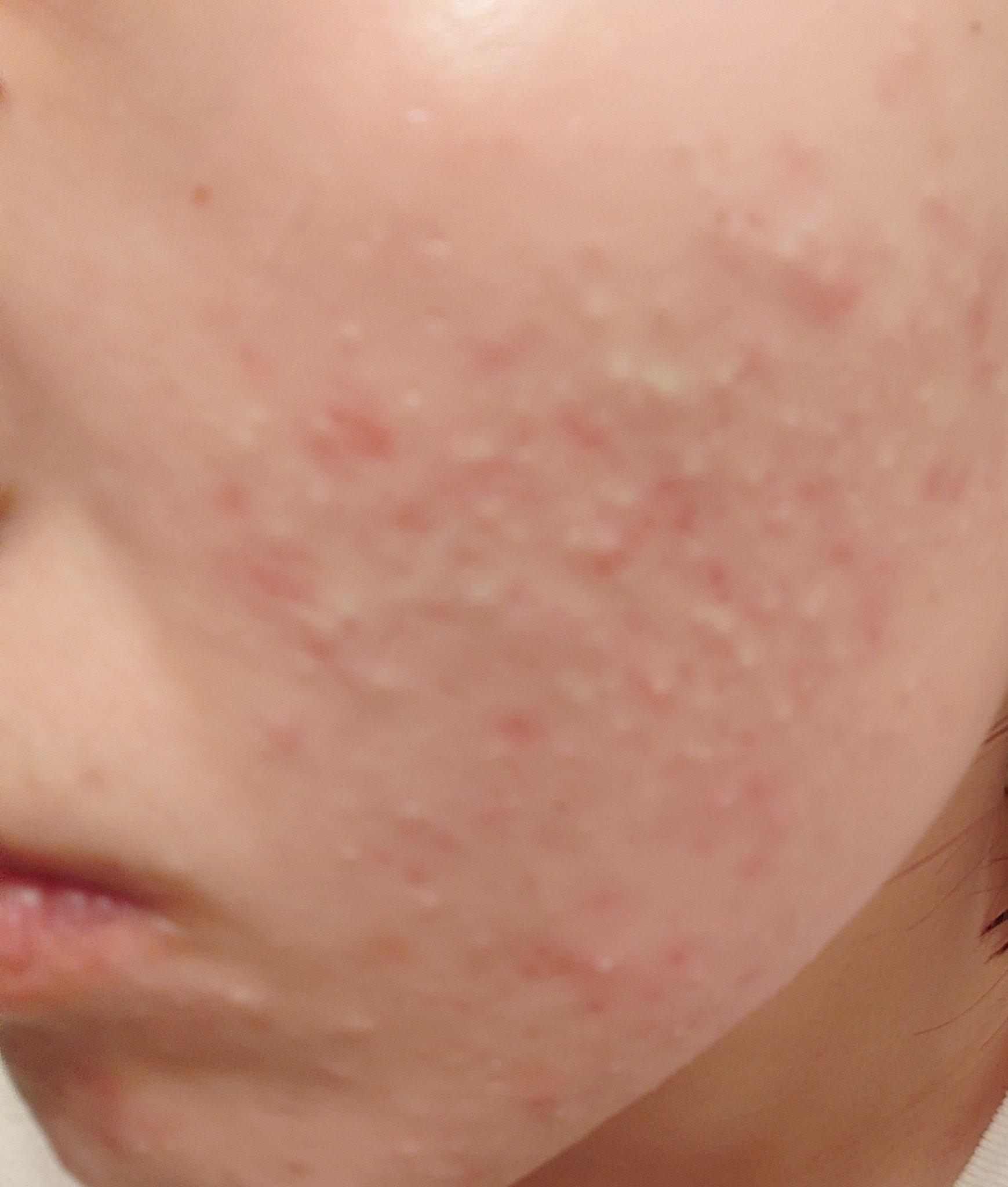 CNPトライアルセット/CNP Laboratory/化粧水を使ったクチコミ（3枚目）