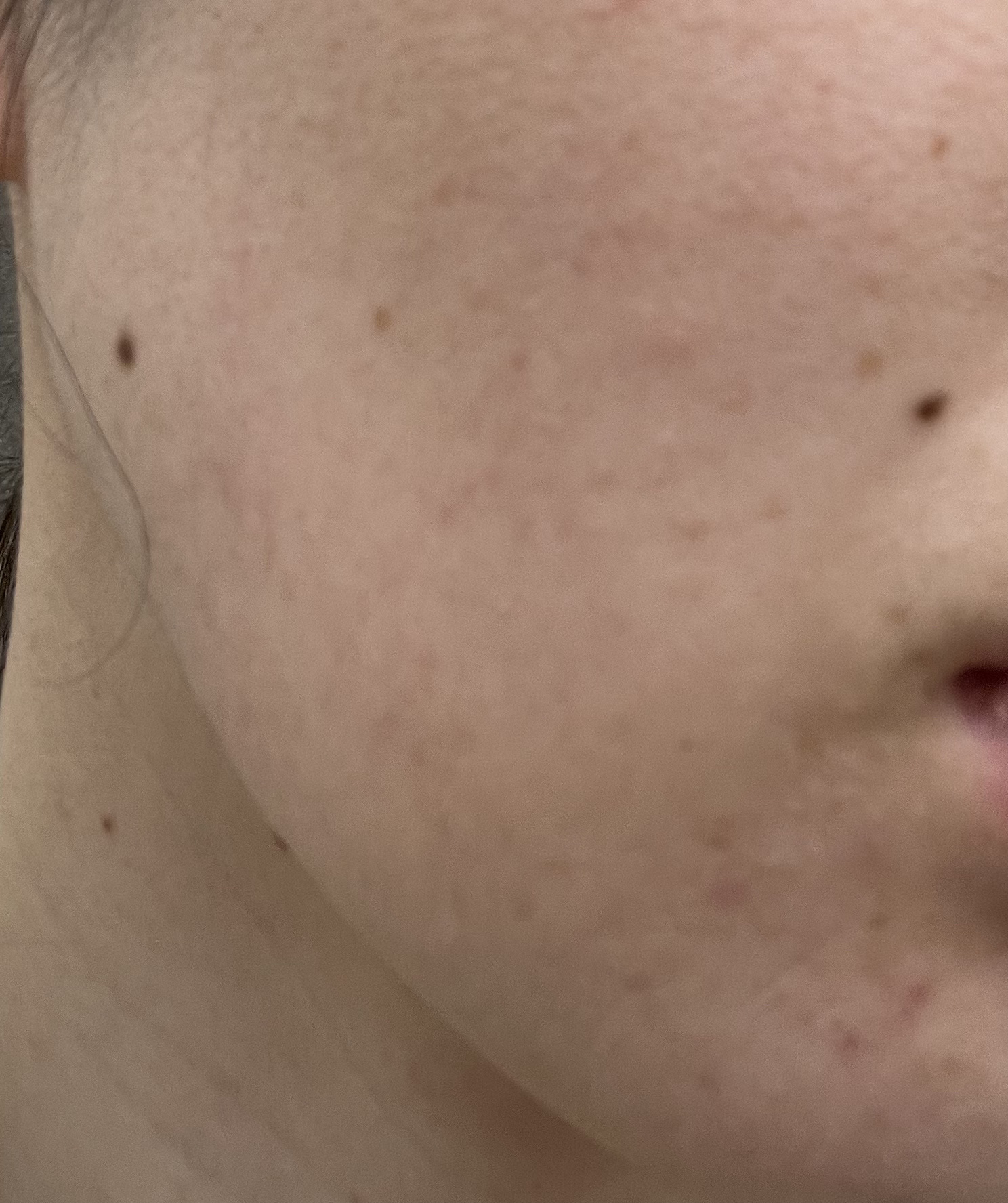 米モデリングマスク/FULLY/シートマスク・パックを使ったクチコミ（2枚目）