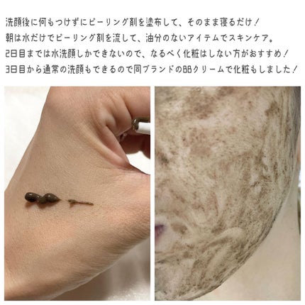 ダーマスキンピーリング/BQCELL/その他キットセットを使ったクチコミ(2枚目)