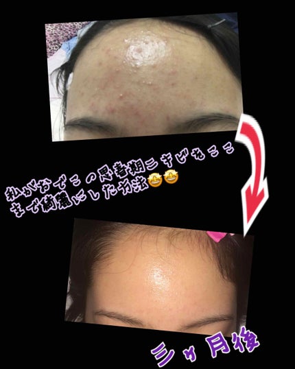 を使ったクチコミ(1枚目)