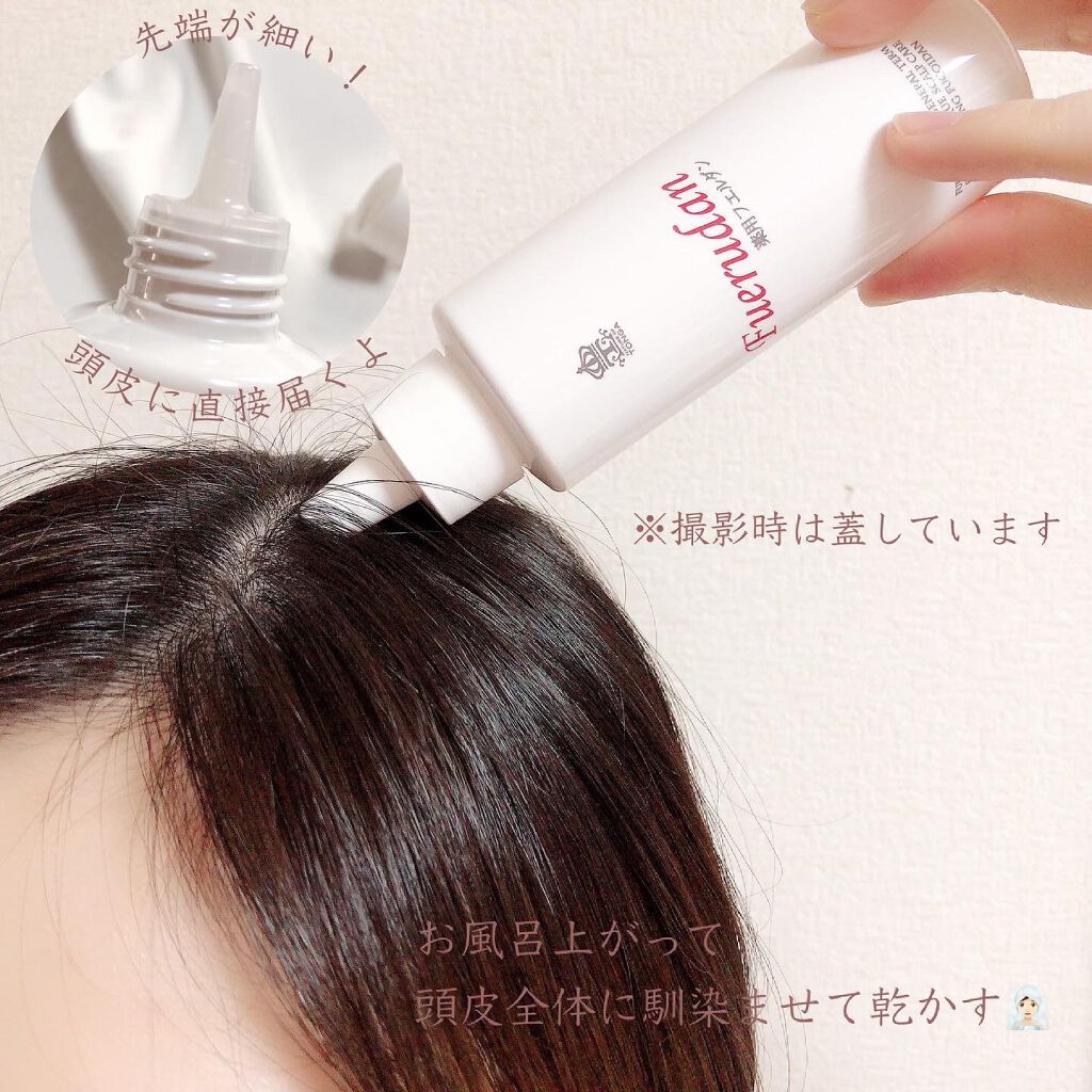 薬用育毛剤フエルダン/リムサプライ/頭皮ローションを使ったクチコミ(4枚目)