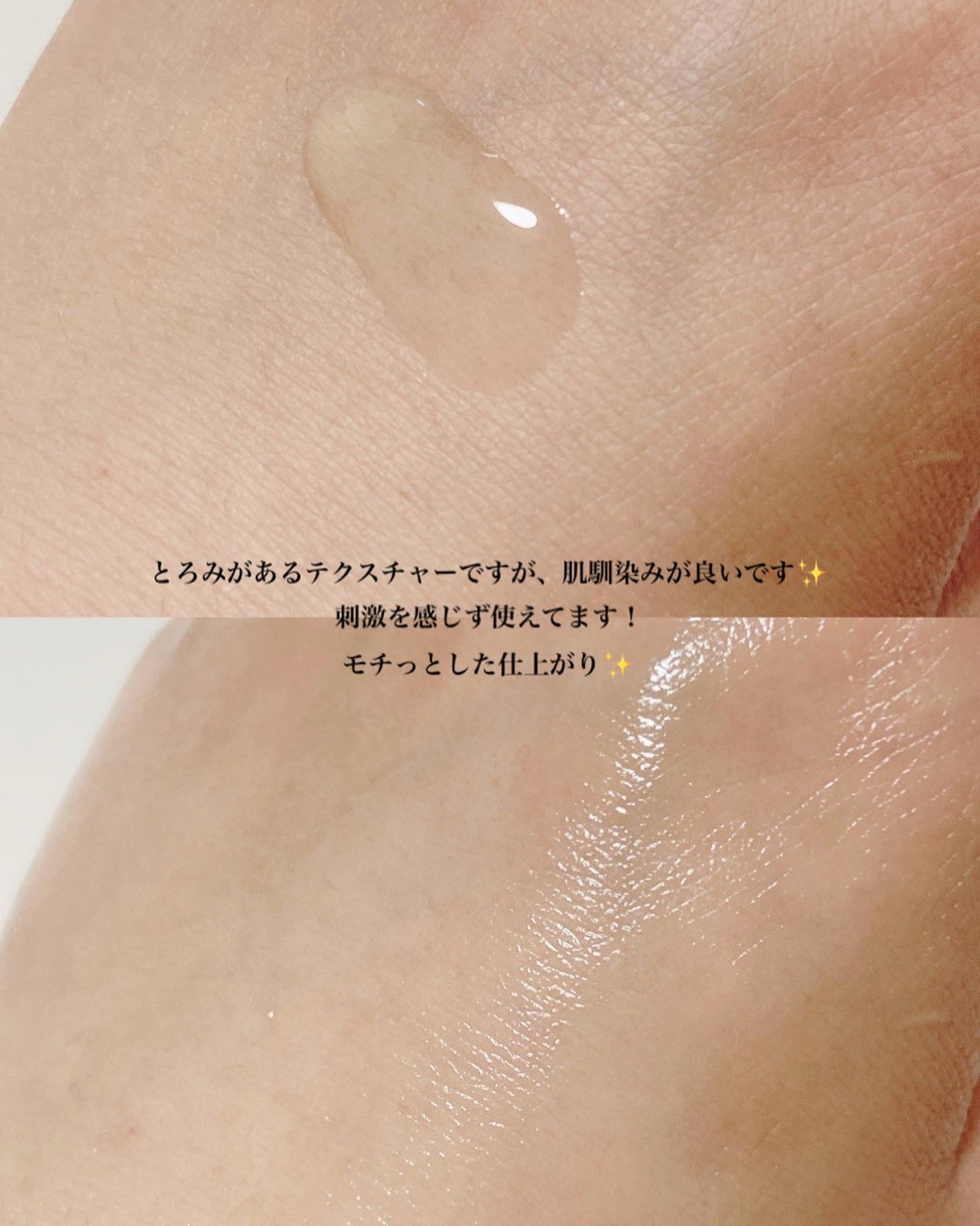 BP-PORE AMPOULE /Dr.Melaxin/美容液を使ったクチコミ(8枚目)