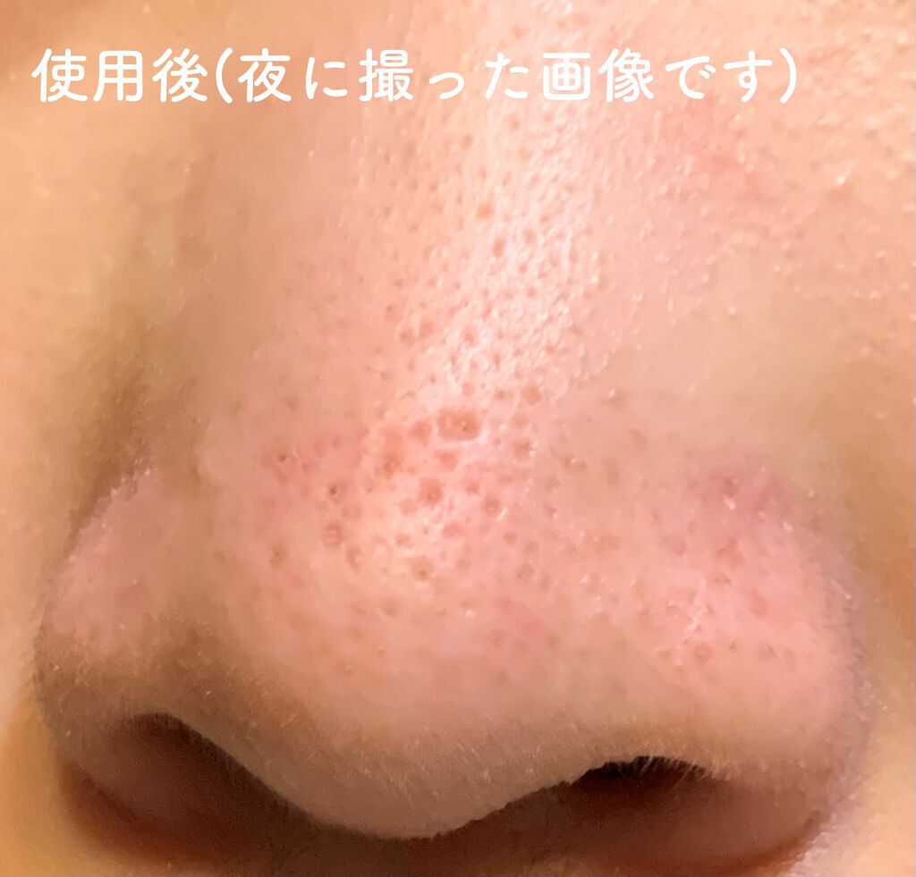 エマルジョンリムーバー 300ml/200ml/水橋保寿堂製薬/その他洗顔料を使ったクチコミ(5枚目)