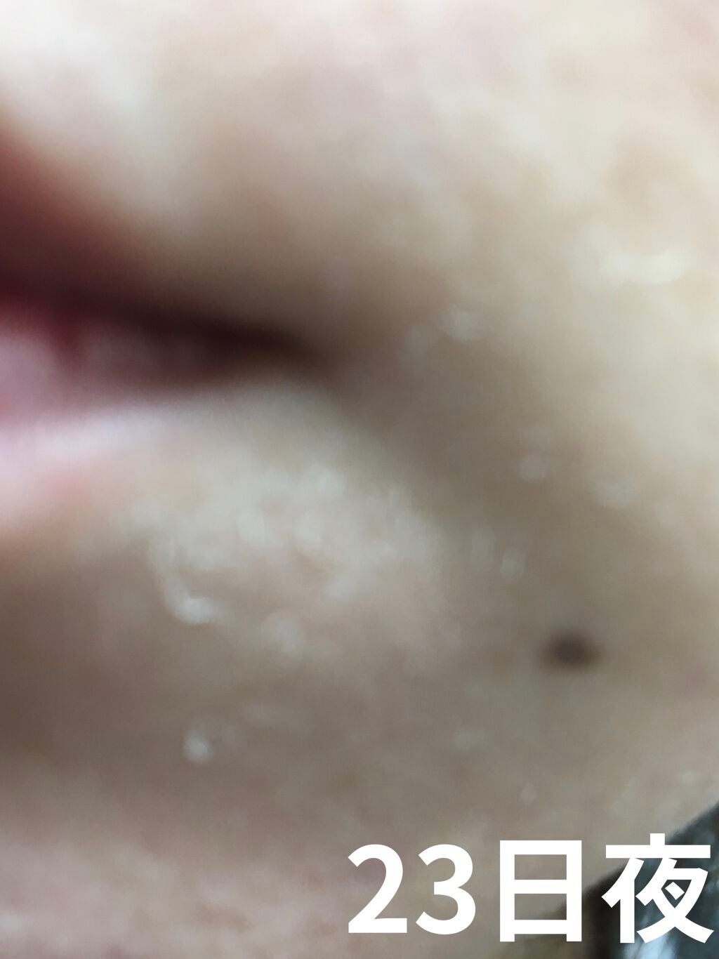 レチノールA 1% アドバンスドリバイタリゼーションクリーム/Life-flo/フェイスクリームを使ったクチコミ(3枚目)