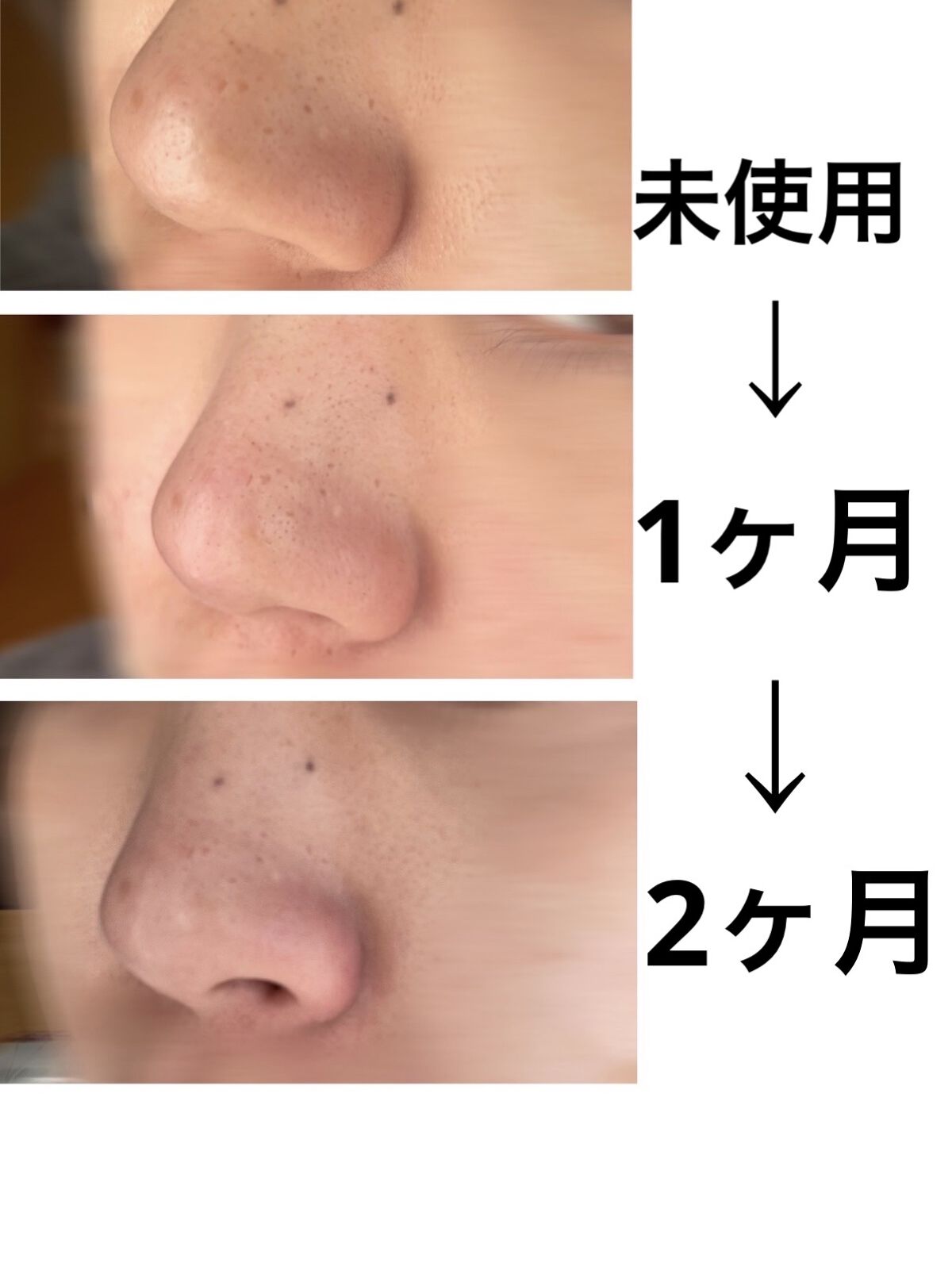 ソフィーナ iP ポア クリアリング ジェル ウォッシュ/SOFINA iP/その他洗顔料を使ったクチコミ（3枚目）