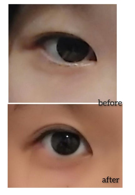 オリシキ アイリッドスキンフィルム		/D-UP/二重まぶた用アイテムを使ったクチコミ(2枚目)