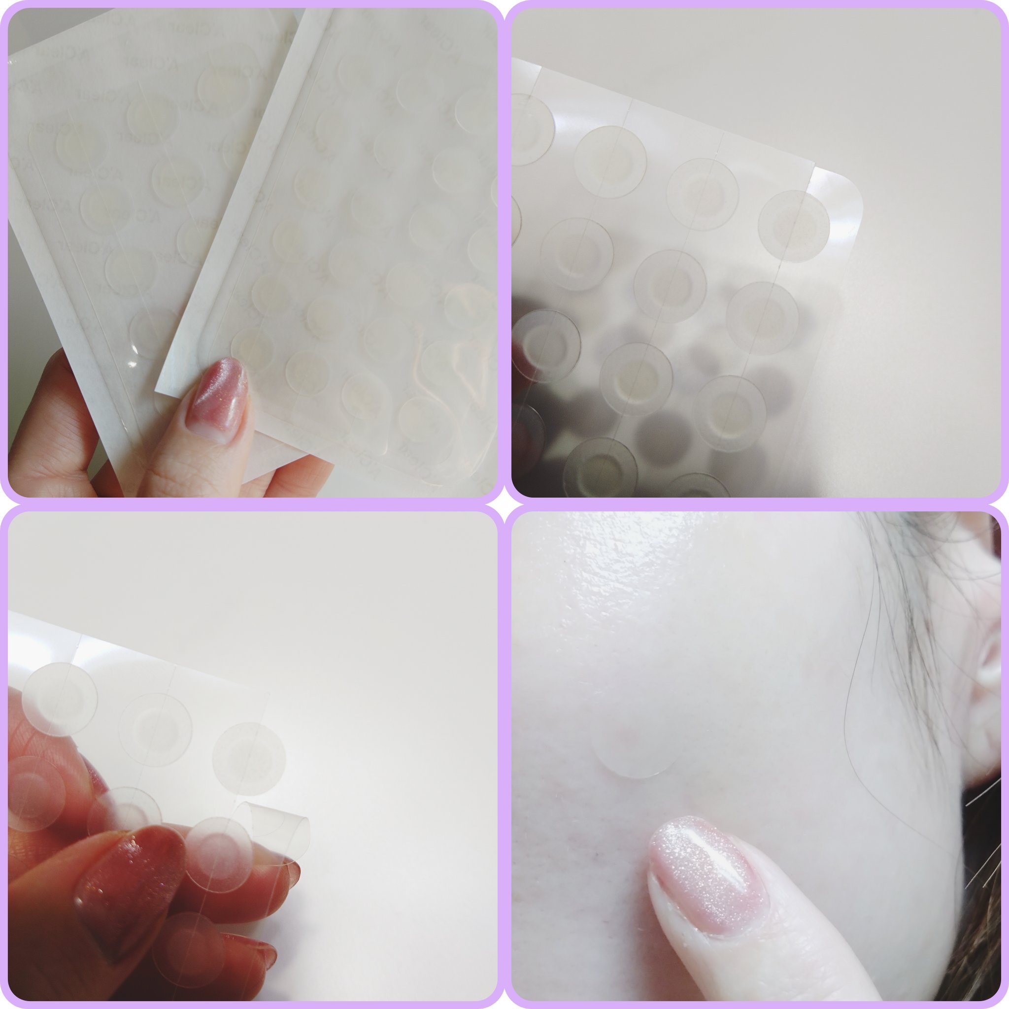 エイクリアスポットキュアパッチ/Dr.G/その他スキンケアを使ったクチコミ（2枚目）