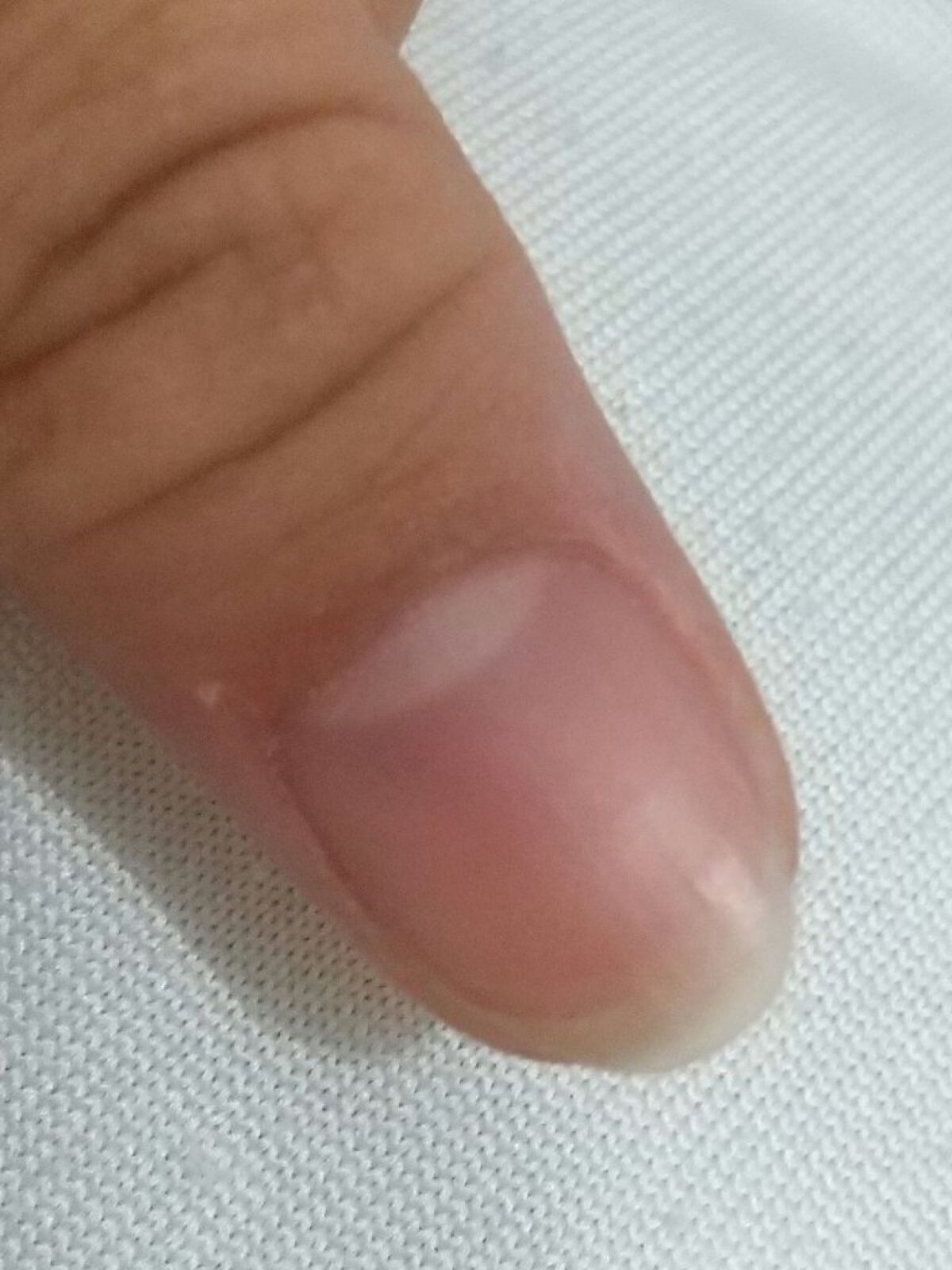 Mimits モイストネイルオイル/ビー・エヌ/ネイルオイル・トリートメントを使ったクチコミ(3枚目)