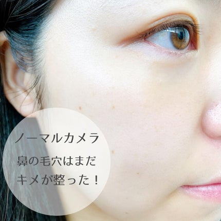 オバジC10セラム/オバジ/美容液を使ったクチコミ(4枚目)